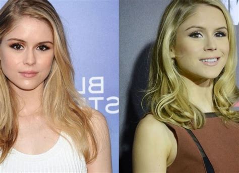 erin moriarty after surgery|Erin Moriarty Was Slammed With Plastic Surgery。